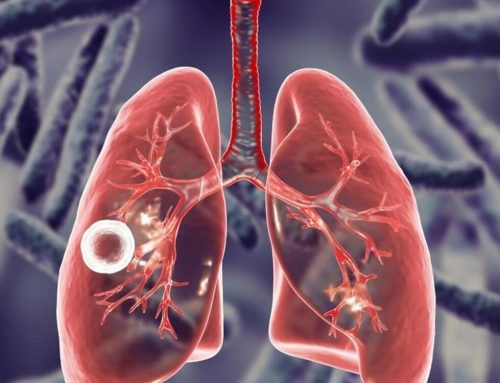 ВІЛ та туберкульоз: чому обізнаність рятує життя